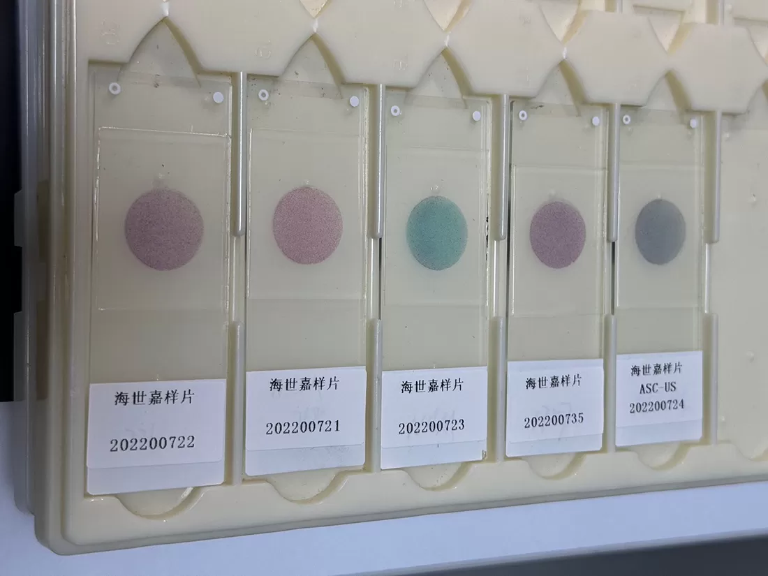 Comment interpréter correctement les résultats des taches Pap