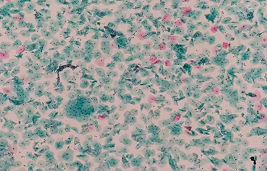 Facteurs influant sur la décoloration des diapositives stainées